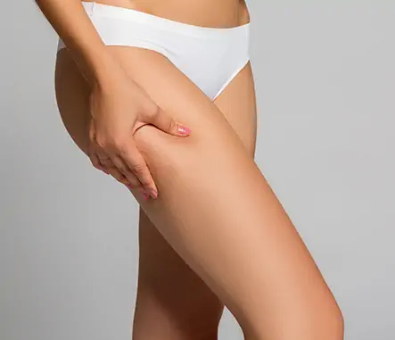 Thigh liposuction Tunisia