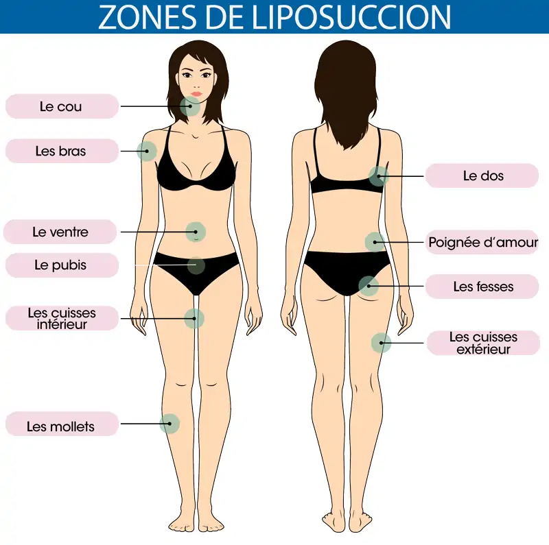 Zones de liposuccion Tunisie