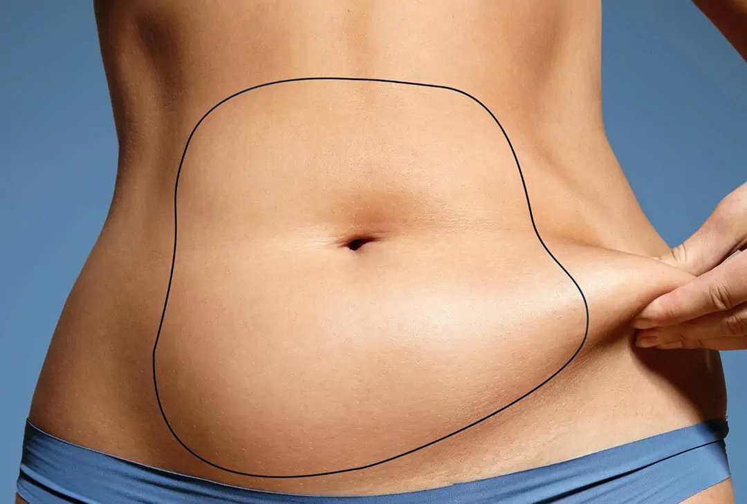 Liposuction Tunisia