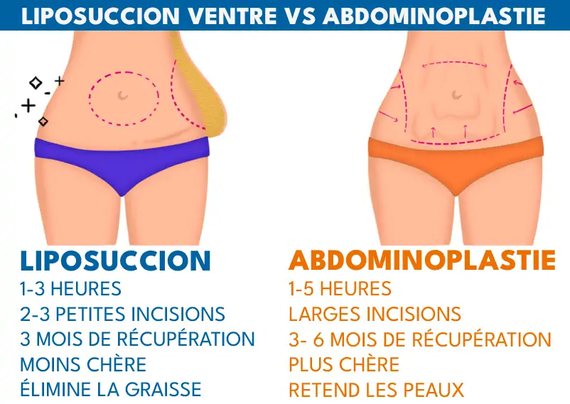 Tummy Tuck or liposuction Tunisie