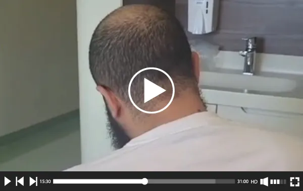 Témoignage Sleeve Turquie