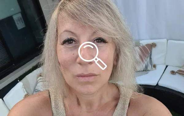 Témoignage chirurgie Turquie